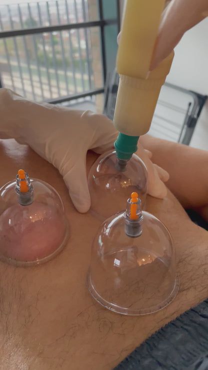 Hijama